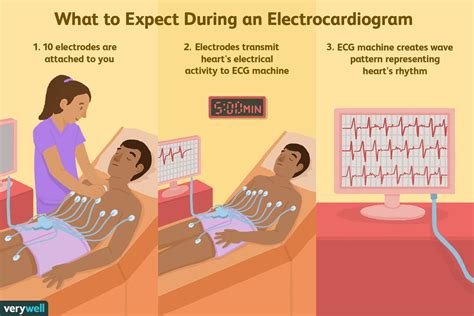 how to check for ekg